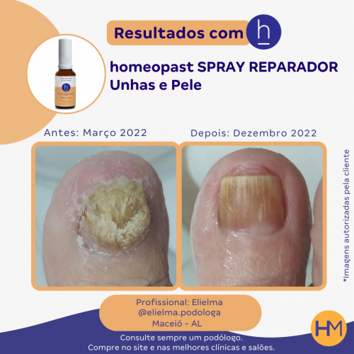 Spray Reparador